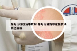 郝萬山桂枝湯牛皮癬 郝萬山講傷寒論桂枝湯的適應(yīng)癥