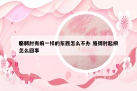 胳膊肘有癬一樣的東西怎么不辦 胳膊肘起癬怎么回事