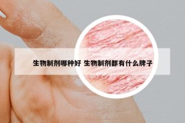生物制劑哪種好 生物制劑都有什么牌子