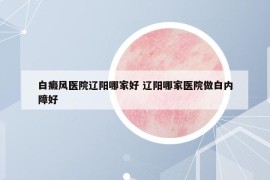 白癜風(fēng)醫(yī)院遼陽哪家好 遼陽哪家醫(yī)院做白內(nèi)障好
