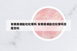 有銀屑病能吃松茸嗎 有銀屑病能吃松茸嗎百度百科