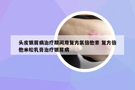 頭皮銀屑病治療期間用復(fù)方氯倍他索 復(fù)方倍他米松乳膏治療銀屑病