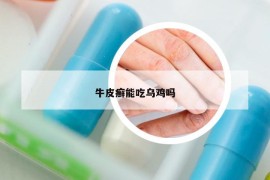 牛皮癬能吃烏雞嗎