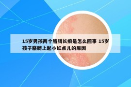 15歲男孩兩個(gè)胳膊長(zhǎng)癬是怎么回事 15歲孩子胳膊上起小紅點(diǎn)兒的原因