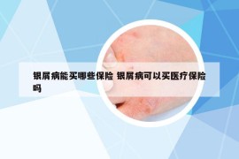 銀屑病能買(mǎi)哪些保險(xiǎn) 銀屑病可以買(mǎi)醫(yī)療保險(xiǎn)嗎