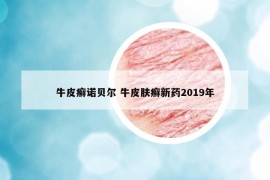 牛皮癬諾貝爾 牛皮膚癬新藥2019年
