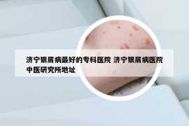 濟(jì)寧銀屑病最好的?？漆t(yī)院 濟(jì)寧銀屑病醫(yī)院中醫(yī)研究所地址