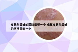 皮膚科最好的醫(yī)院是哪一個 成都皮膚科最好的醫(yī)院是哪一個