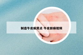 制造牛皮癬窩點(diǎn) 牛皮膚癬視頻