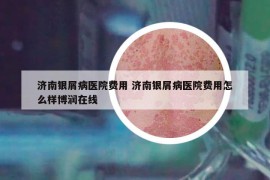 濟南銀屑病醫(yī)院費用 濟南銀屑病醫(yī)院費用怎么樣博潤在線