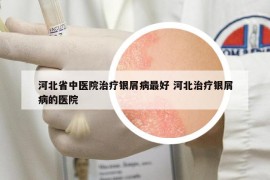 河北省中醫(yī)院治療銀屑病最好 河北治療銀屑病的醫(yī)院