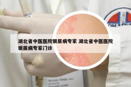 湖北省中醫(yī)醫(yī)院銀屑病專家 湖北省中醫(yī)醫(yī)院銀屑病專家門診