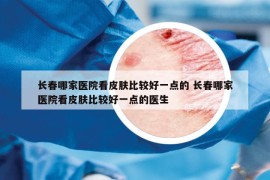 長(zhǎng)春哪家醫(yī)院看皮膚比較好一點(diǎn)的 長(zhǎng)春哪家醫(yī)院看皮膚比較好一點(diǎn)的醫(yī)生