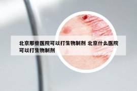 北京那些醫(yī)院可以打生物制劑 北京什么醫(yī)院可以打生物制劑