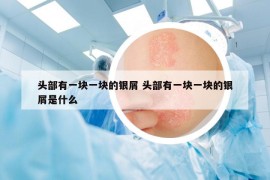 頭部有一塊一塊的銀屑 頭部有一塊一塊的銀屑是什么