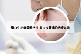 ?？谂Ｆぐ_最新療法 ?？谄つw病的治療辦法