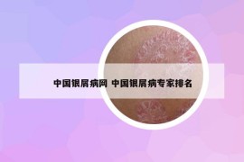 中國(guó)銀屑病網(wǎng) 中國(guó)銀屑病專(zhuān)家排名