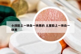 小孩臉上一塊白一塊黑的 兒童臉上一塊白一塊黑