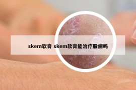 skem軟膏 skem軟膏能治療股癬嗎