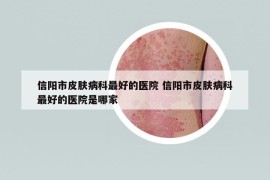 信陽市皮膚病科最好的醫(yī)院 信陽市皮膚病科最好的醫(yī)院是哪家