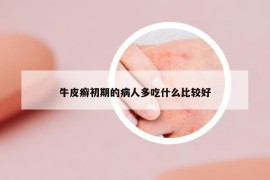 牛皮癬初期的病人多吃什么比較好
