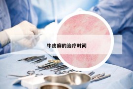 牛皮癬的治療時間