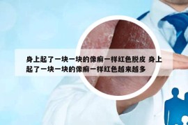 身上起了一塊一塊的像癬一樣紅色脫皮 身上起了一塊一塊的像癬一樣紅色越來越多