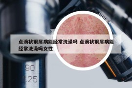 點滴狀銀屑病能經(jīng)常洗澡嗎 點滴狀銀屑病能經(jīng)常洗澡嗎女性