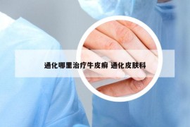 通化哪里治療牛皮癬 通化皮膚科