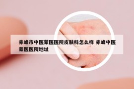 赤峰市中醫(yī)蒙醫(yī)醫(yī)院皮膚科怎么樣 赤峰中醫(yī)蒙醫(yī)醫(yī)院地址