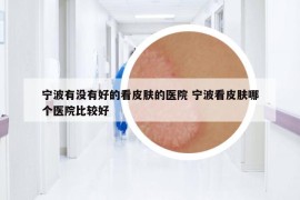 寧波有沒(méi)有好的看皮膚的醫(yī)院 寧波看皮膚哪個(gè)醫(yī)院比較好