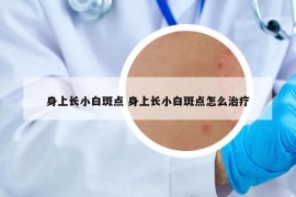 身上長小白斑點 身上長小白斑點怎么治療