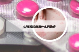 生殖器起癬用什么藥治療