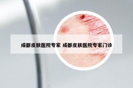 成都皮膚醫(yī)院專(zhuān)家 成都皮膚醫(yī)院專(zhuān)家門(mén)診