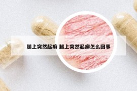 腿上突然起癬 腿上突然起癬怎么回事