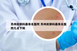 蘇州皮膚科最有名醫(yī)院 蘇州皮膚科最有名醫(yī)院幾點(diǎn)下班