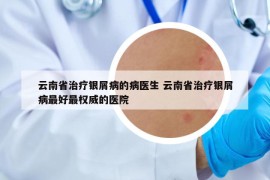 云南省治療銀屑病的病醫(yī)生 云南省治療銀屑病最好最權(quán)威的醫(yī)院