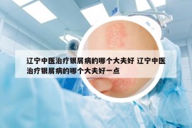 遼寧中醫(yī)治療銀屑病的哪個大夫好 遼寧中醫(yī)治療銀屑病的哪個大夫好一點(diǎn)