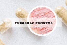 皮癬需要忌什么口 皮癬的飲食禁忌