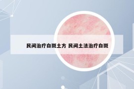 民間治療白斑土方 民間土法治療白斑