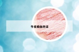 牛皮癬血熱證