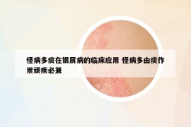 怪病多痰在銀屑病的臨床應(yīng)用 怪病多由痰作祟頑疾必兼