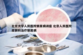 北京大學(xué)人民醫(yī)院銀屑病講座 北京人民醫(yī)院皮膚科治療銀屑病