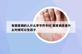 有銀屑病的人什么季節(jié)懷孕好 銀屑病患者什么時候可以生孩子