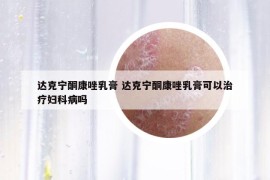 達(dá)克寧酮康唑乳膏 達(dá)克寧酮康唑乳膏可以治療婦科病嗎