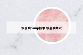 銀屑病camp技術(shù) 銀屑病共識(shí)