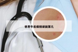 世界牛皮癬排頑固第幾