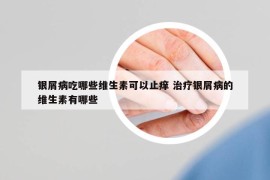 銀屑病吃哪些維生素可以止癢 治療銀屑病的維生素有哪些