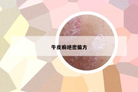牛皮癬絕密偏方