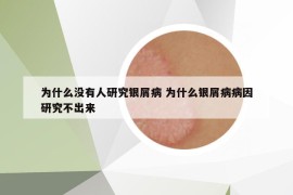 為什么沒有人研究銀屑病 為什么銀屑病病因研究不出來